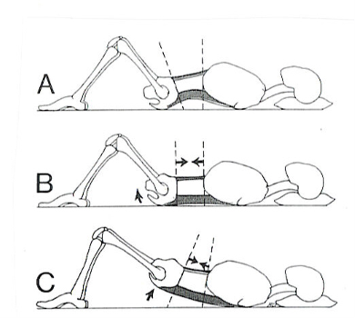 condition13